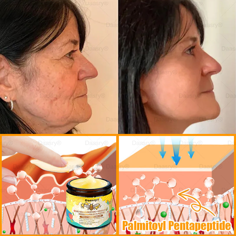 TGA Official: Daasry® Botox Bee Venom Skin Restoration Cream - Anti-aging, Hydrating, Skin Firming & Lifting, Skin Repair, Even Tone, Acne and Dark Spot Treatment, Wart and Mole Removal, and Psoriasis Relief.