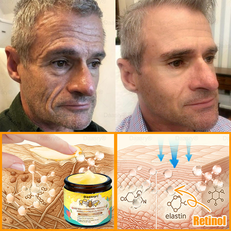 TGA Official: Daasry® Botox Bee Venom Skin Restoration Cream - Anti-aging, Hydrating, Skin Firming & Lifting, Skin Repair, Even Tone, Acne and Dark Spot Treatment, Wart and Mole Removal, and Psoriasis Relief.