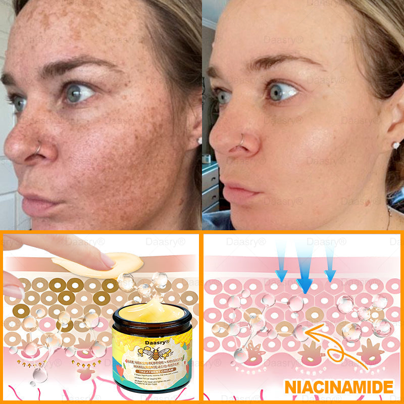 TGA Official: Daasry® Botox Bee Venom Skin Restoration Cream - Anti-aging, Hydrating, Skin Firming & Lifting, Skin Repair, Even Tone, Acne and Dark Spot Treatment, Wart and Mole Removal, and Psoriasis Relief.