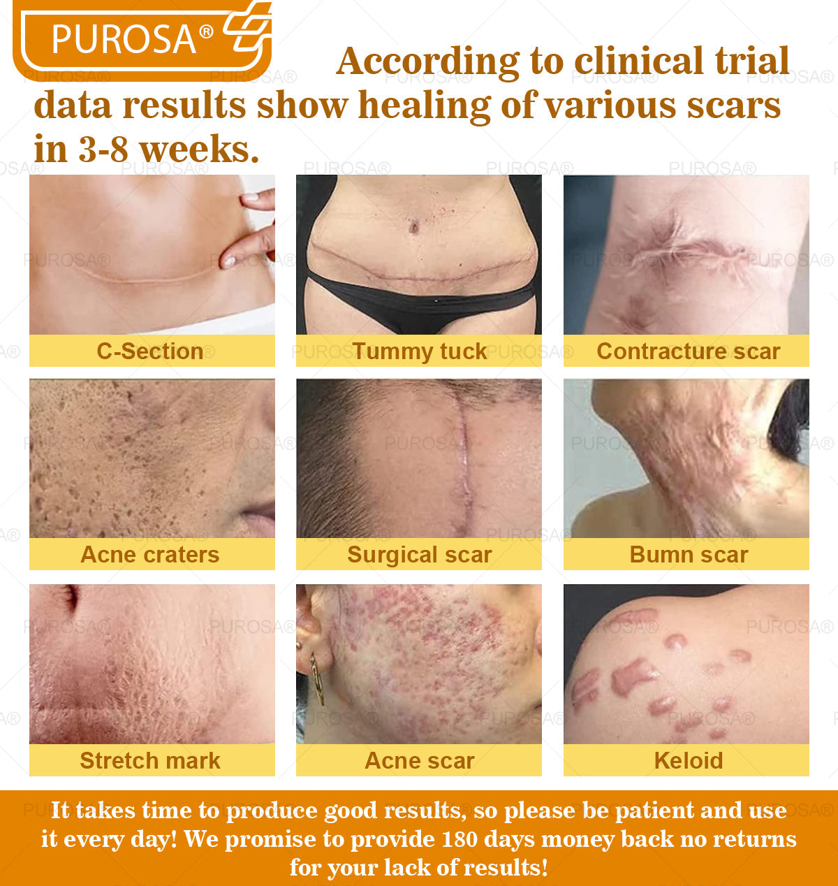 Limited to 10 jars! đPUROSAÂźâExclusive 30% discount, restore your skin's youthful glow in just 1-3 weeks! A rare opportunity â wonât be available again until next year, donât miss out!180-day money-back guarantee, full refund with no risk!