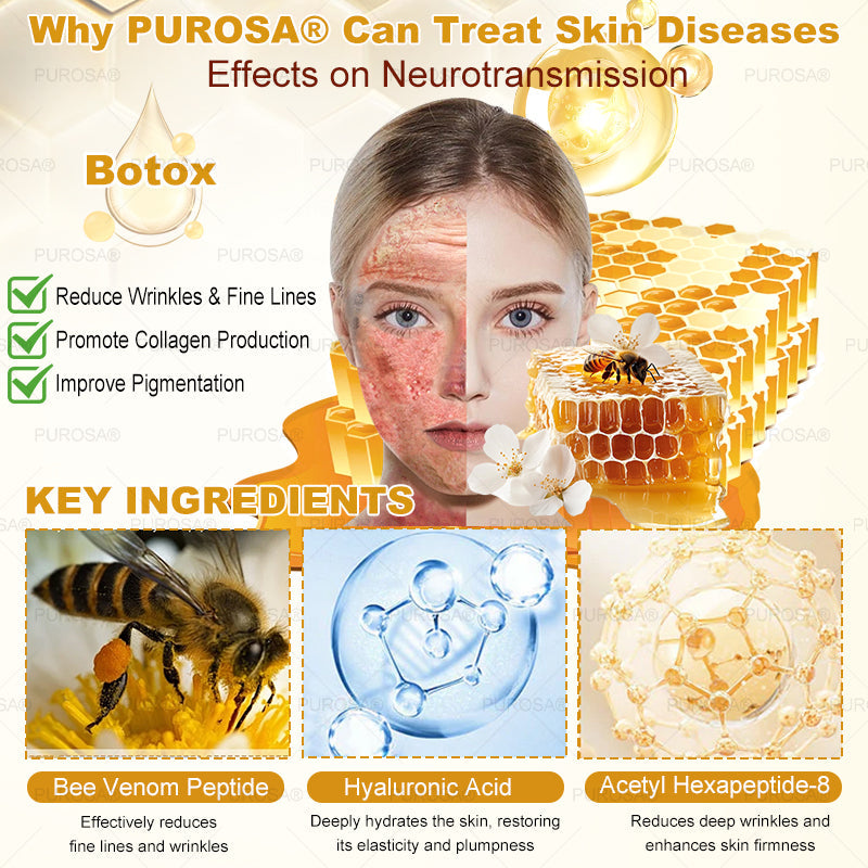 Limited to 10 jars! đPUROSAÂźâExclusive 30% discount, restore your skin's youthful glow in just 1-3 weeks! A rare opportunity â wonât be available again until next year, donât miss out!180-day money-back guarantee, full refund with no risk!