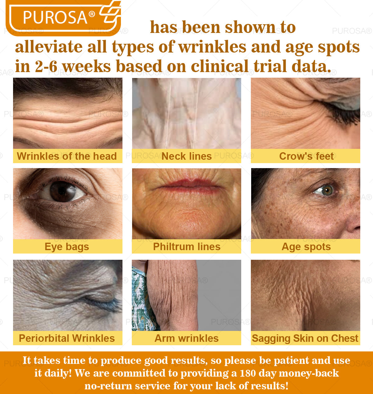 Limited to 10 jars! 🌟PUROSA®—Exclusive 30% discount, restore your skin's youthful glow in just 1-3 weeks! A rare opportunity — won’t be available again until next year, don’t miss out!180-day money-back guarantee, full refund with no risk!
