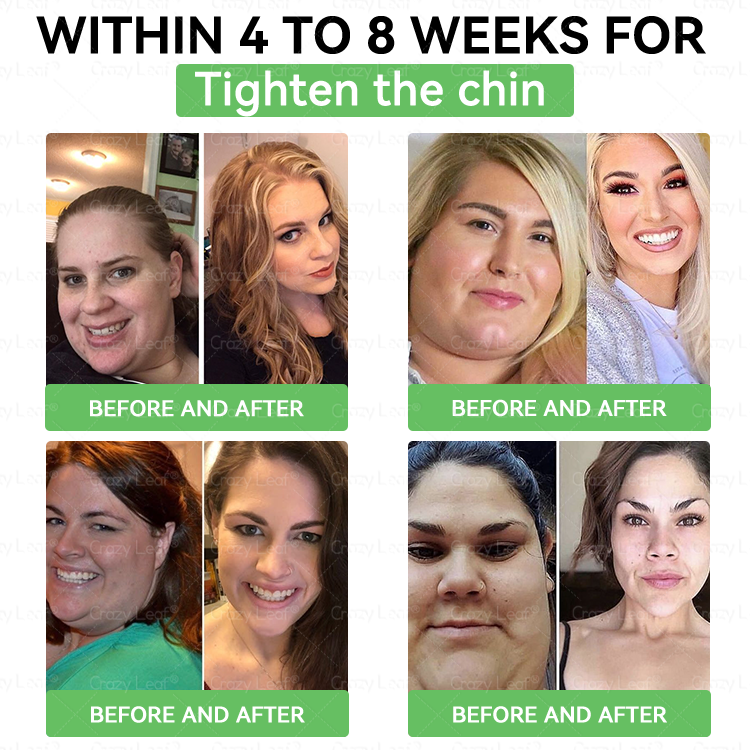 Crazyleaf® 🎁One last chance! Grab this lucky find at 50% OFF!🔥180-day money back guarantee! Free air shipping!