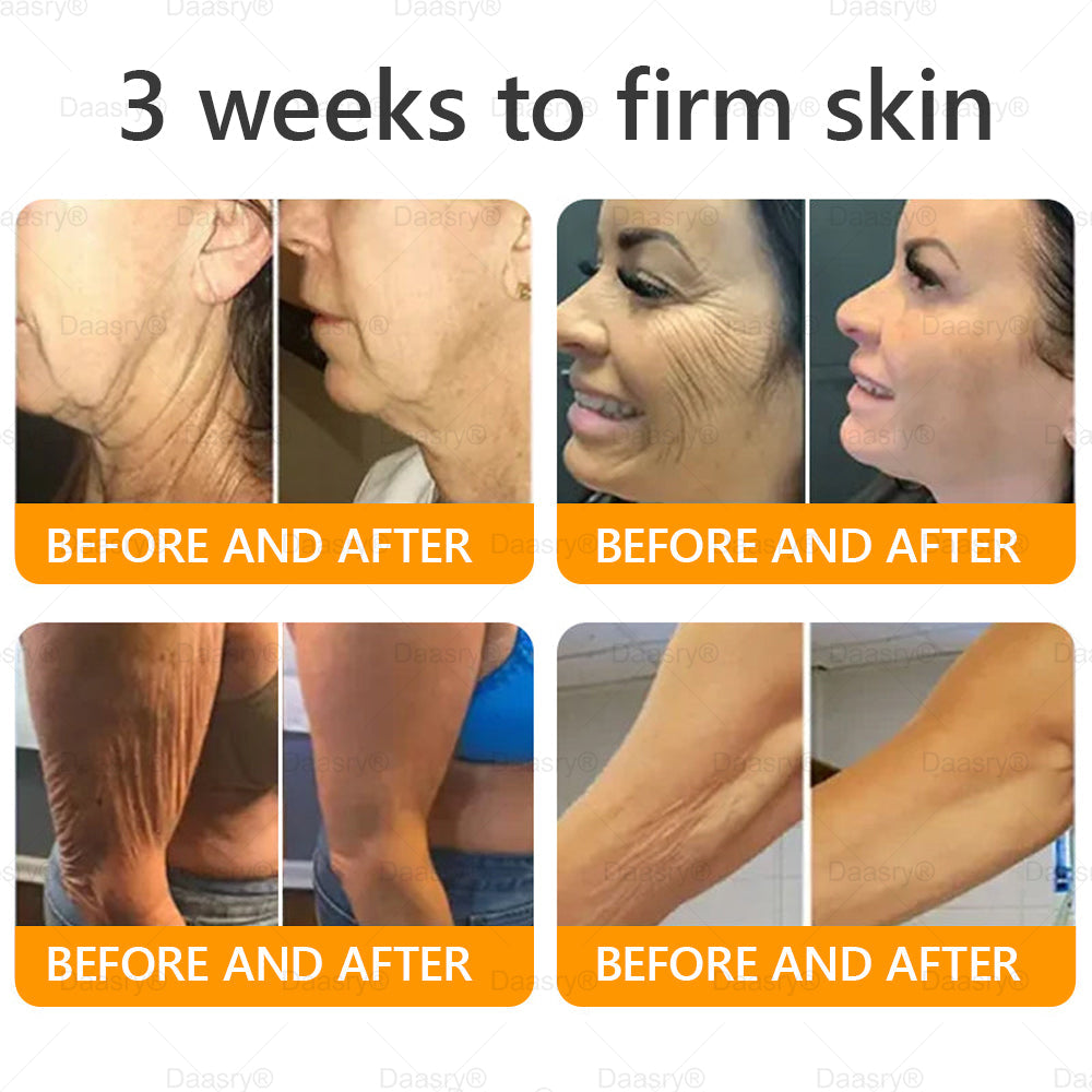 TGA Official: Daasry® Botox Bee Venom Skin Restoration Cream - Anti-aging, Hydrating, Skin Firming & Lifting, Skin Repair, Even Tone, Acne and Dark Spot Treatment, Wart and Mole Removal, and Psoriasis Relief.