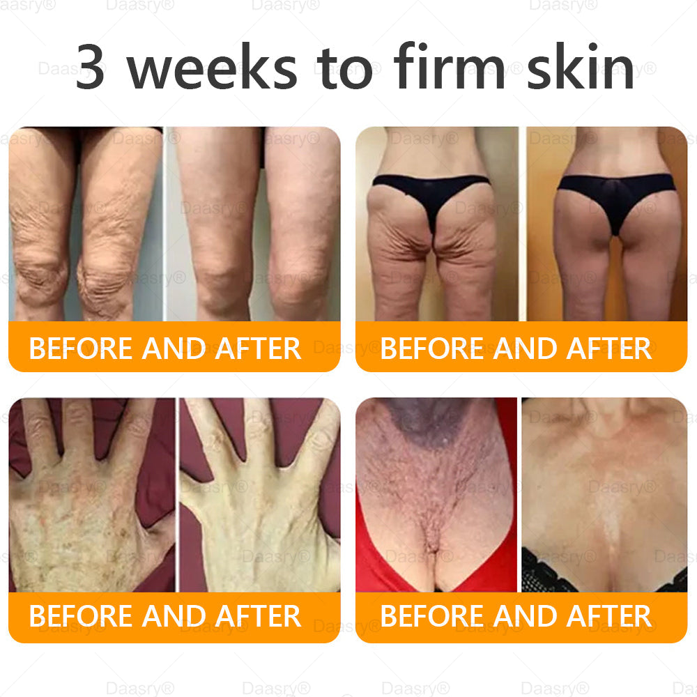TGA Official: Daasry® Botox Bee Venom Skin Restoration Cream - Anti-aging, Hydrating, Skin Firming & Lifting, Skin Repair, Even Tone, Acne and Dark Spot Treatment, Wart and Mole Removal, and Psoriasis Relief.