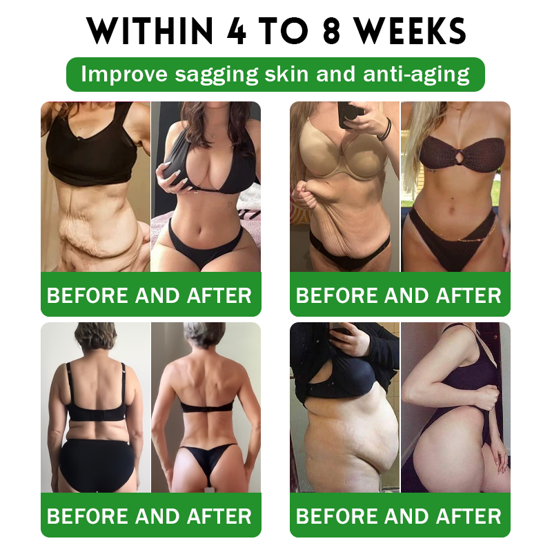 𝖮𝖿𝖿𝗂𝖼𝗂𝖺𝗅 𝖲𝗍𝗈𝗋𝖾 | 𝑩𝒖𝐢𝒍𝒅𝑳𝒆𝐚𝒇® GL𝐏-1 6-𝒊𝒏-1 𝑯𝒆𝒂𝒍𝒕𝒉 𝑺𝒐𝒍𝒖𝒕𝒊𝒐𝒏 𝖮𝗋𝖺𝗅 𝐋𝐢𝐪𝐮𝐢𝐝 (𝑱𝒖𝒔𝒕 𝒐𝒏𝒄𝒆 𝒂 𝒅𝒂𝒚, 𝘃𝗶𝘀𝗶𝗯𝗹𝗲 𝗰𝗵𝗮𝗻𝗴𝗲𝘀 𝗶𝗻 𝟳 𝗱𝗮𝘆𝘀） ✅ 𝘍𝘰𝘳 𝘰𝘣𝘦𝘴𝘪𝘵𝘺, 𝘤𝘢𝘳𝘥𝘪𝘰𝘷𝘢𝘴𝘤𝘶𝘭𝘢𝘳 𝘩𝘦𝘢𝘭𝘵𝘩,𝙙𝙞𝙖𝙗𝙚𝙩𝙚𝙨, 𝙨𝙡𝙚𝙚𝙥 𝐚𝐩𝐧𝐞𝐚, 𝐆𝐮𝐭 𝐇𝐞𝐚𝐥𝐭𝐡, 𝐣𝐨𝐢𝐧𝐭 𝐢𝐬𝐬𝐮𝐞𝐬, 𝐚𝐧𝐝 𝐦𝐨𝐫𝐞