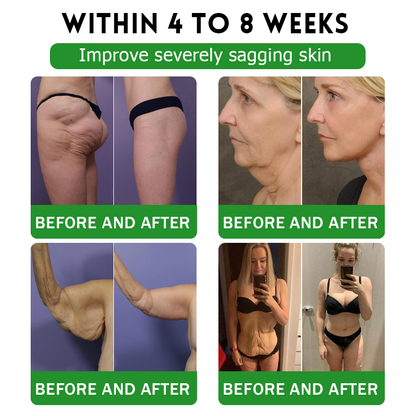 𝖮𝖿𝖿𝗂𝖼𝗂𝖺𝗅 𝖲𝗍𝗈𝗋𝖾 | 𝑩𝒖𝐢𝒍𝒅𝑳𝒆𝐚𝒇® GL𝐏-1 6-𝒊𝒏-1 𝑯𝒆𝒂𝒍𝒕𝒉 𝑺𝒐𝒍𝒖𝒕𝒊𝒐𝒏 𝖮𝗋𝖺𝗅 𝐋𝐢𝐪𝐮𝐢𝐝 (𝑱𝒖𝒔𝒕 𝒐𝒏𝒄𝒆 𝒂 𝒅𝒂𝒚, 𝘃𝗶𝘀𝗶𝗯𝗹𝗲 𝗰𝗵𝗮𝗻𝗴𝗲𝘀 𝗶𝗻 𝟳 𝗱𝗮𝘆𝘀） ✅ 𝘍𝘰𝘳 𝘰𝘣𝘦𝘴𝘪𝘵𝘺, 𝘤𝘢𝘳𝘥𝘪𝘰𝘷𝘢𝘴𝘤𝘶𝘭𝘢𝘳 𝘩𝘦𝘢𝘭𝘵𝘩,𝙙𝙞𝙖𝙗𝙚𝙩𝙚𝙨, 𝙨𝙡𝙚𝙚𝙥 𝐚𝐩𝐧𝐞𝐚, 𝐆𝐮𝐭 𝐇𝐞𝐚𝐥𝐭𝐡, 𝐣𝐨𝐢𝐧𝐭 𝐢𝐬𝐬𝐮𝐞𝐬, 𝐚𝐧𝐝 𝐦𝐨𝐫𝐞